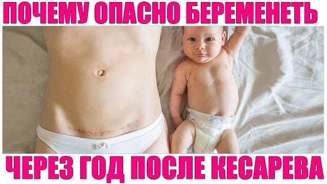 БЕРЕМЕННОСТЬ В ТЕЧЕНИЕ ГОДА ПОСЛЕ КЕСАРЕВА СЕЧЕНИЯ | Когда можно забеременеть после кесарева сечения БЕРЕМЕННОСТЬ В ТЕЧЕНИЕ ГОДА ПОСЛЕ КЕСАРЕВА СЕЧЕНИЯ | Когда можно забеременеть после кесарева сечения