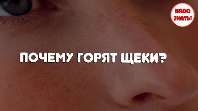 Почему горят щеки? Почему горят щеки?