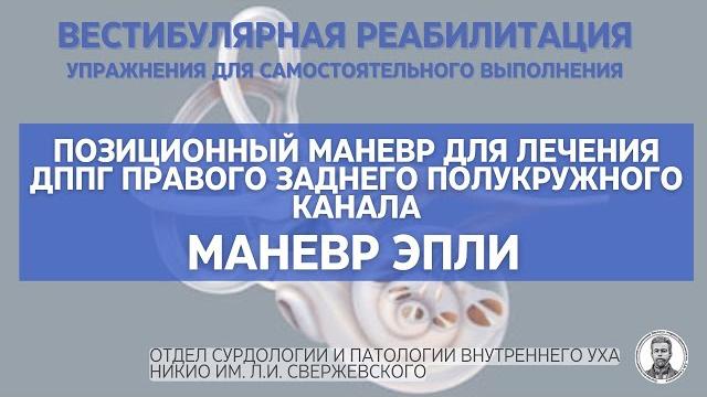 Маневр Эпли - вестибулярная реабилитация Маневр Эпли - вестибулярная реабилитация
