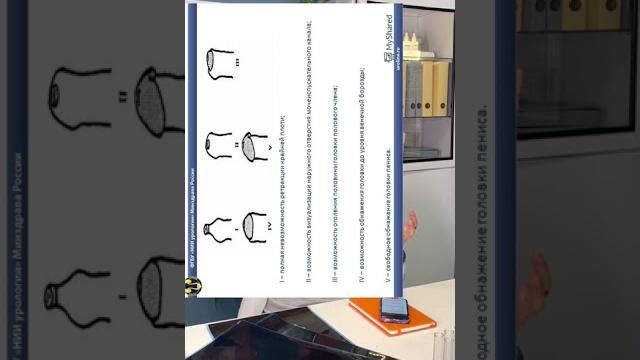 Головка не открывается, фимоз! Обрезание?! #vtrepal #shorts Головка не открывается, фимоз! Обрезание?! #vtrepal #shorts