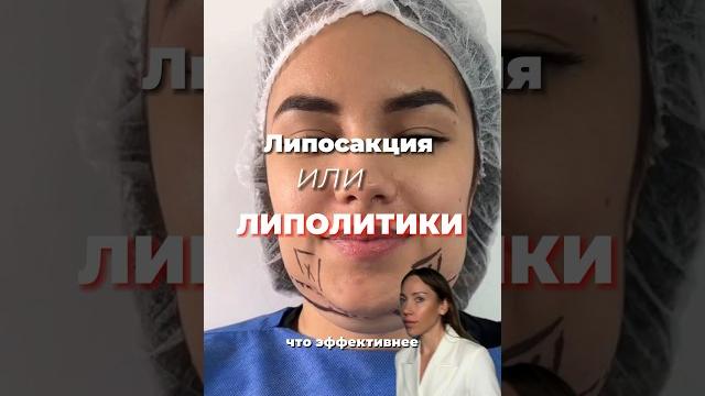Липосакция или липолитиков , убираем второй подбородок #второйподбородок #липосакция #липолитики Липосакция или липолитиков , убираем второй подбородок #второйподбородок #липосакция #липолитики