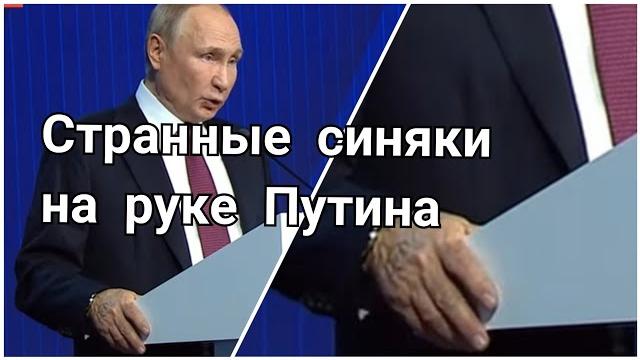 Странные синяки на руке Путина Странные синяки на руке Путина