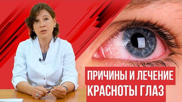 Покраснение глаз. Причины и лечение красноты глаз. Покраснение глаз. Причины и лечение красноты глаз.