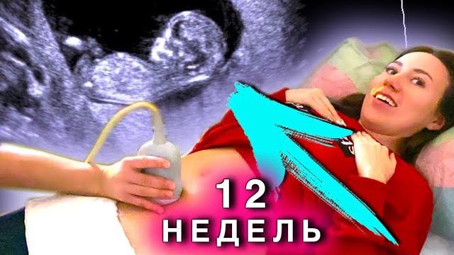 УВИДЕЛИ МАЛЫША - Мальчик ИЛИ Девочка ? Третье УЗИ 12 Недель 1 Скрининг - Я БЕРЕМЕННА | Elli Di УВИДЕЛИ МАЛЫША - Мальчик ИЛИ Девочка ? Третье УЗИ 12 Недель 1 Скрининг - Я БЕРЕМЕННА | Elli Di
