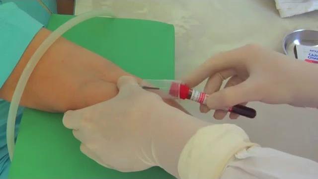Забор крови из вены Забор крови из вены