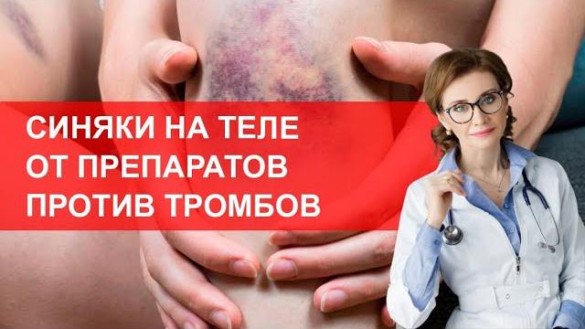 Синяки на теле от лекарств против тромбов Синяки на теле от лекарств против тромбов