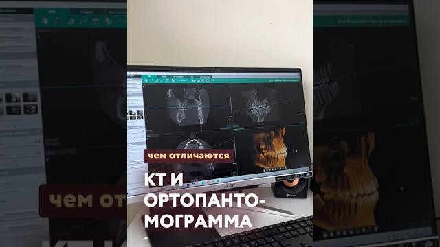 Чем отличается КТ и ОРТОПАНТОМОГРАММА? Чем отличается КТ и ОРТОПАНТОМОГРАММА?