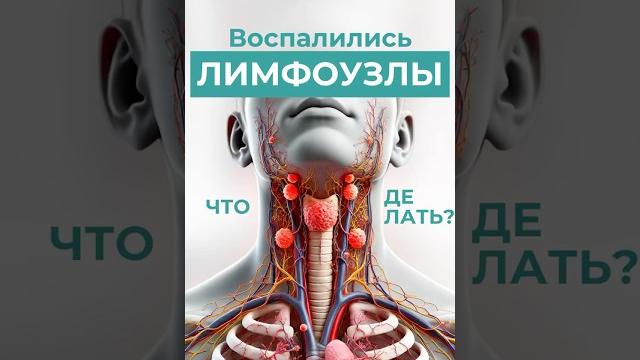 Воспалились лимфоузлы? Читайте описание, что делать в таких случаях #медицина #вопросответ Воспалились лимфоузлы? Читайте описание, что делать в таких случаях #медицина #вопросответ