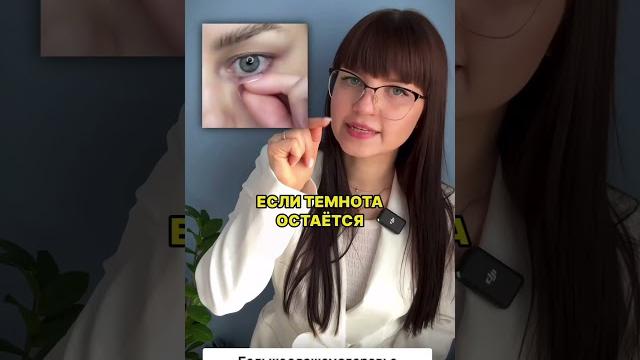 Черные круги под глазами,что делать? #полезныесоветы Черные круги под глазами,что делать? #полезныесоветы