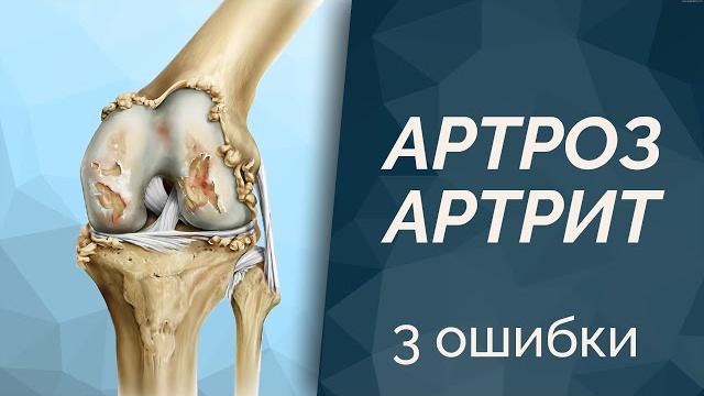 3 ошибки в лечении Артроз и Артирт 3 ошибки в лечении Артроз и Артирт