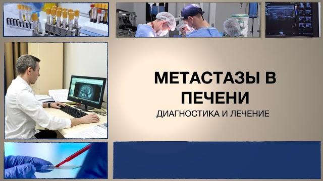 Метастазы в печени: диагностика и лечение. Метастазы в печени: диагностика и лечение.