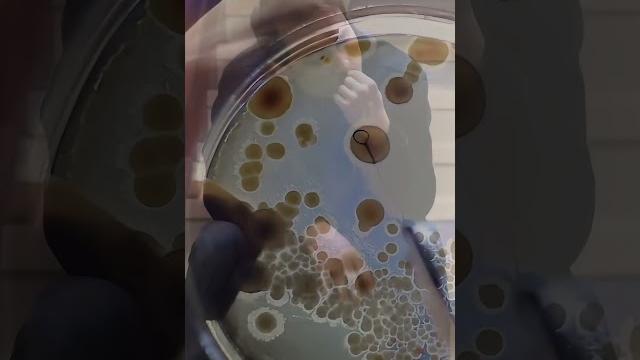 Почему Нельзя Грызть НОГТИ Почему Нельзя Грызть НОГТИ