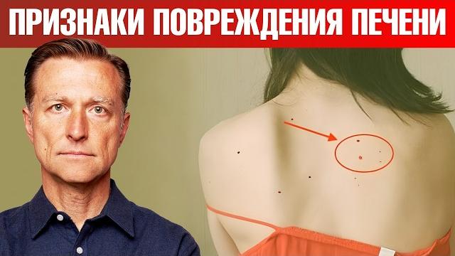 7 РАННИХ признаков повреждения печени 7 РАННИХ признаков повреждения печени