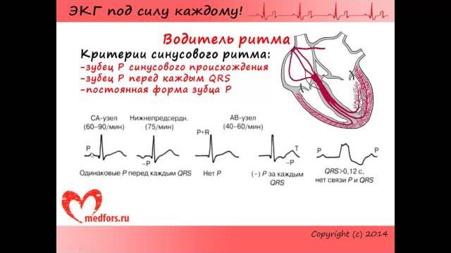 Урок 3. Видеокурс "ЭКГ под силу каждому". Урок 3. Видеокурс "ЭКГ под силу каждому".
