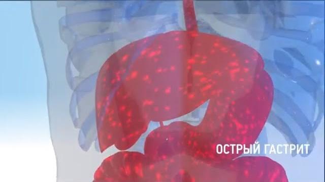 Энтеросгель при похмелье Энтеросгель при похмелье
