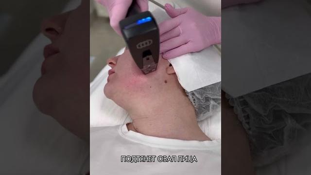 RF-LIFTING на аппарате MORPHEUS 8 дарим скидку до -20% на все процедуры клиники Лейлы Роз️ RF-LIFTING на аппарате MORPHEUS 8 дарим скидку до -20% на все процедуры клиники Лейлы Роз️