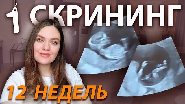 1 скрининг беременных | УЗИ 12 недель | Что видно на скрининге первого триместра? Пол ребенка 1 скрининг беременных | УЗИ 12 недель | Что видно на скрининге первого триместра? Пол ребенка