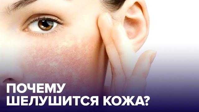 Почему КОЖА ШЕЛУШИТСЯ и как ее спасти? Почему КОЖА ШЕЛУШИТСЯ и как ее спасти?