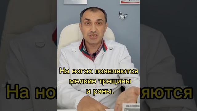 Почему чешутся ноги при варикозе? Флеболог Москва. Почему чешутся ноги при варикозе? Флеболог Москва.