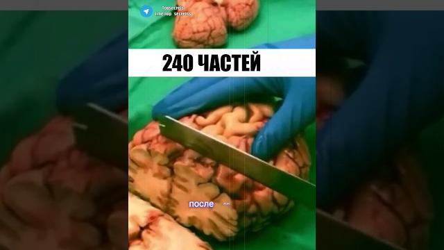 Тайна мозга Альберта Эйнштейна Тайна мозга Альберта Эйнштейна