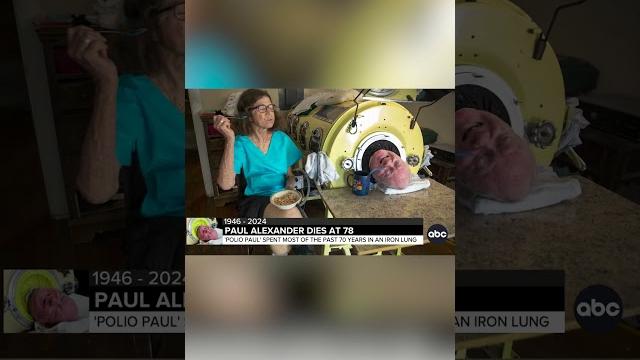 ‘Polio Paul,’ man who lived in iron lung, dies at 78 ‘Polio Paul,’ man who lived in iron lung, dies at 78