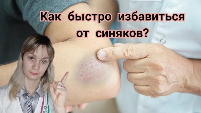 Как быстро избавиться от синяков? 911 Как быстро избавиться от синяков? 911