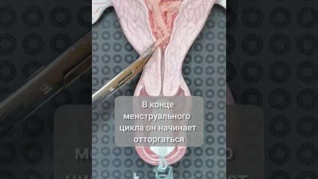 Что такое менструация? #shorts #гинеколог #врач Что такое менструация? #shorts #гинеколог #врач