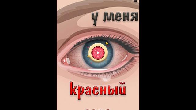 Травма глаза | покраснение глаз #shorts Травма глаза | покраснение глаз #shorts