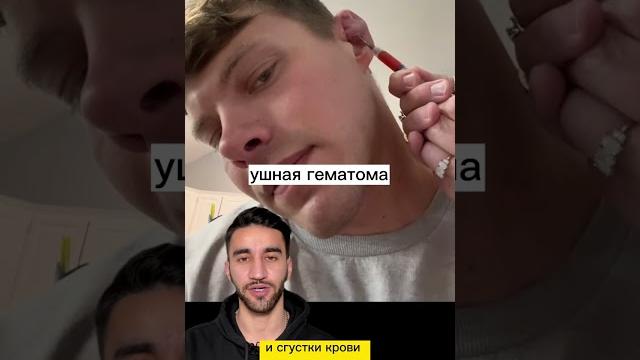уши борца уши борца