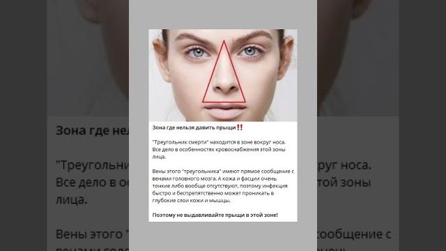 Вокруг носа нельзя давить прыщи, и вот почему #прыщи #прыщиналице #полезнознать #здоровье Вокруг носа нельзя давить прыщи, и вот почему #прыщи #прыщиналице #полезнознать #здоровье