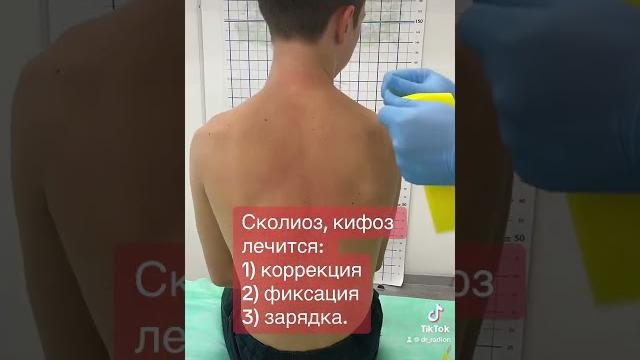 Как лечить сколиоз у подростка. Как лечить сколиоз у подростка.