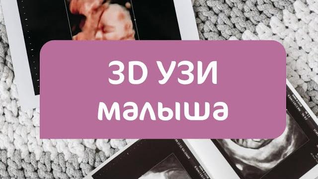 3D УЗИ малыша 3D УЗИ малыша