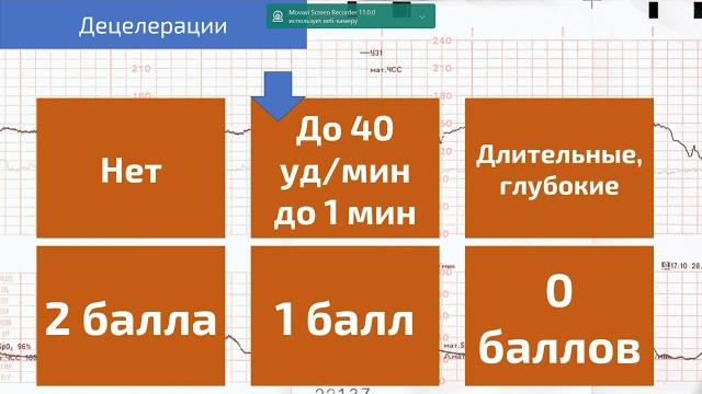 КТГ по Fisher КТГ по Fisher