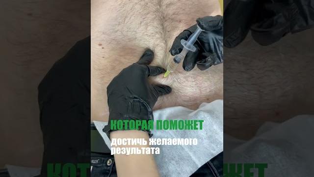 Липолитики Липолитики