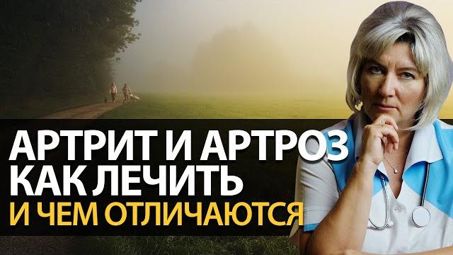 Артрит и артроз лечение. Чем отличается артрит от артроза. Воспаление суставов симптомы Артрит и артроз лечение. Чем отличается артрит от артроза. Воспаление суставов симптомы