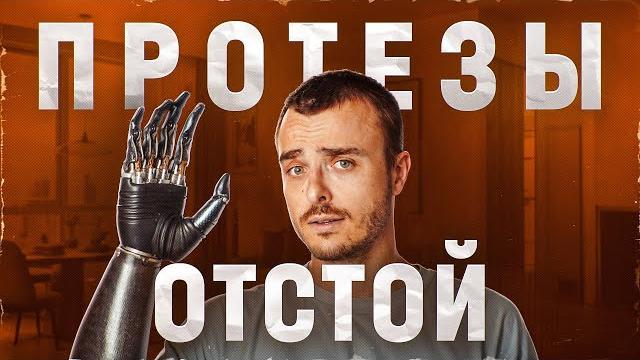 10 лет живу без рук. Я ЗА*БАЛСЯ 10 лет живу без рук. Я ЗА*БАЛСЯ