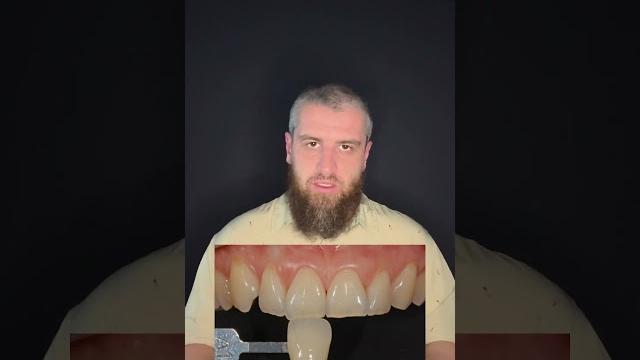 О важности фотографии в стоматологии. Рассказать подробнее? #виниры #dentist #стоматология О важности фотографии в стоматологии. Рассказать подробнее? #виниры #dentist #стоматология