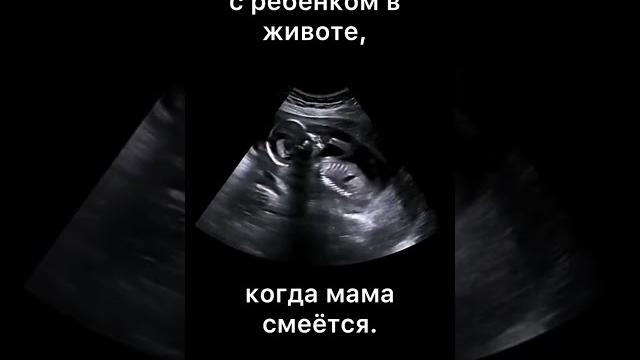 Вот что происходит с ребёнком в животе, когда мама смеётся. #мама #ребенок #приколы #рекомендации Вот что происходит с ребёнком в животе, когда мама смеётся. #мама #ребенок #приколы #рекомендации
