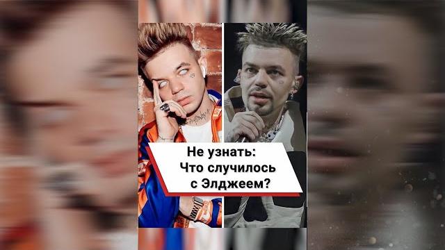Не узнать: Что случилось с Элджеем? #shorts Не узнать: Что случилось с Элджеем? #shorts