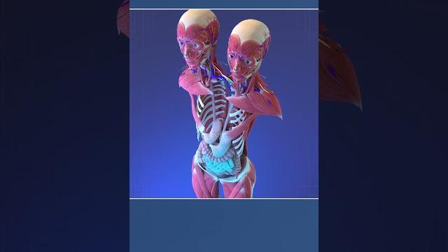 Two Heads, One Body: Anatomy of Conjoined Twins Two Heads, One Body: Anatomy of Conjoined Twins