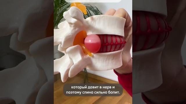 Если у Вас грыжа или протрузия, делайте ТАК Если у Вас грыжа или протрузия, делайте ТАК