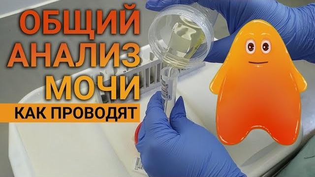 Как выполняется общий анализ мочи в лаборатории. Как выполняется общий анализ мочи в лаборатории.