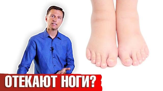 Отекают ноги: что делать? Как лечить отеки ног? Отекают ноги: что делать? Как лечить отеки ног?