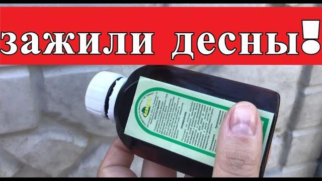 МОЩНЫЙ ЭФФЕКТ! Зажили ДЕСНЫ, И ПАРОДОНТОЗ Исчез! МОЩНЫЙ ЭФФЕКТ! Зажили ДЕСНЫ, И ПАРОДОНТОЗ Исчез!