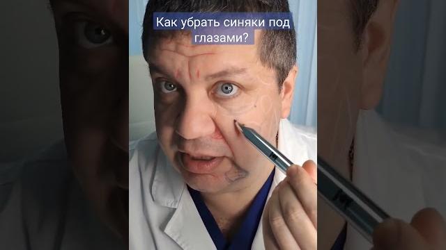 Как быстро избавиться от синяков под глазами? Как быстро избавиться от синяков под глазами?