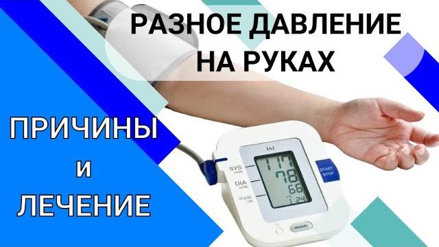 РАЗНОЕ ДАВЛЕНИЕ НА РУКАХ: причины и лечение РАЗНОЕ ДАВЛЕНИЕ НА РУКАХ: причины и лечение