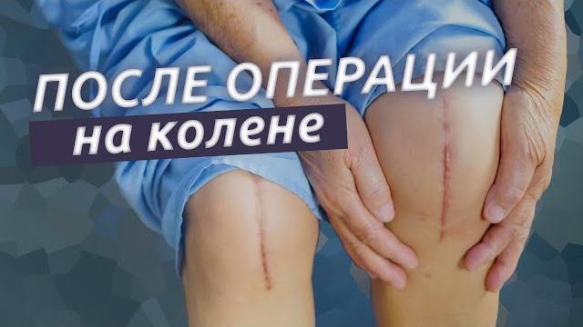 После операции на колене. Первые 2 недели. После операции на колене. Первые 2 недели.