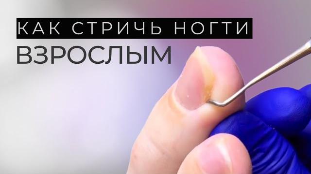 Как правильно стричь ногти взрослым? Как правильно стричь ногти взрослым?