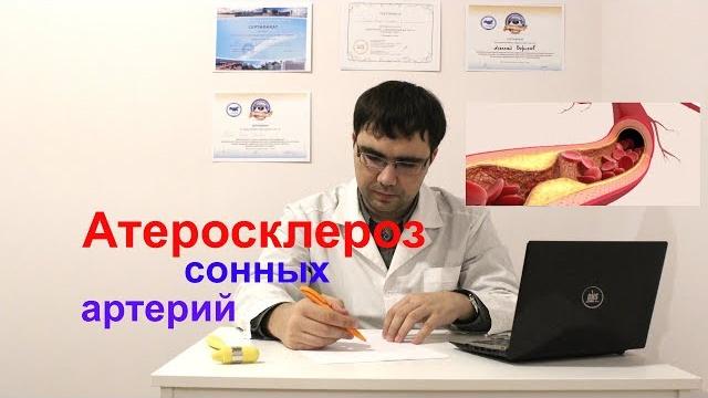 Атерокслероз сонных артерий: симптомы, лечение Атерокслероз сонных артерий: симптомы, лечение