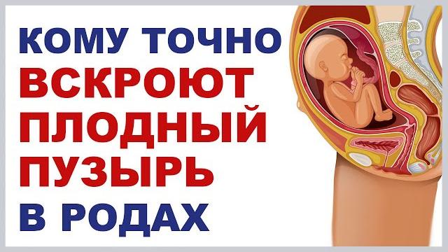 Амниотомия. Вскрытие плодного пузыря. Родить "в рубашке". Когда прокалывают плодный пузырь в родах? Амниотомия. Вскрытие плодного пузыря. Родить "в рубашке". Когда прокалывают плодный пузырь в родах?